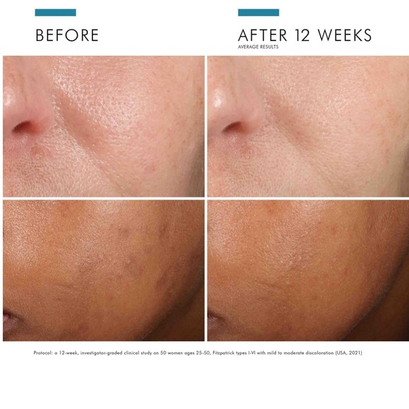 SkinCeuticals Vitamin C Serum Phloretin CF BRAND NEW NEVER OPENED IN BOX - Picture 4 of 5